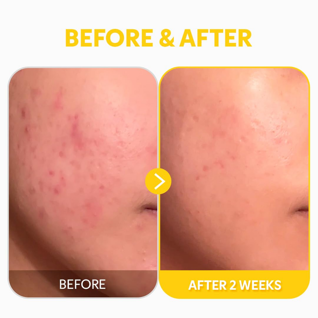 TIRTIR Pure Vitamin C 24% Face Serum 30mL