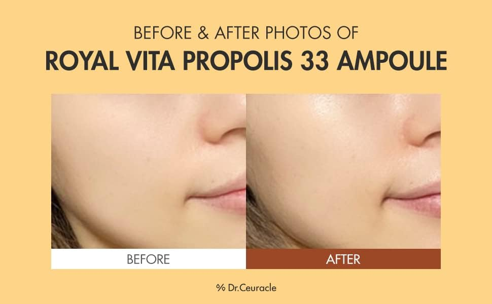 Dr.Ceuracle Royal Vita Propolis 33 Ampoule 30mL