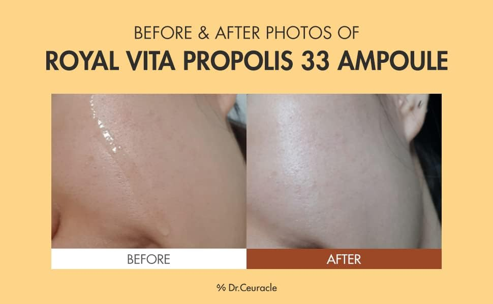 Dr.Ceuracle Royal Vita Propolis 33 Ampoule 30mL