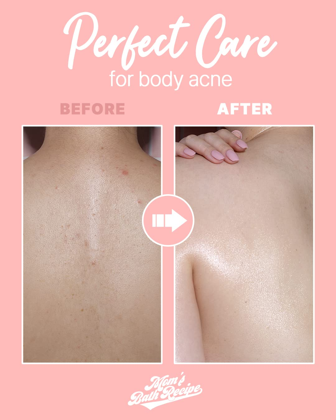 Mom’s Bath Recipe Body Peeling Pad Trouble Care (Single Sheet)