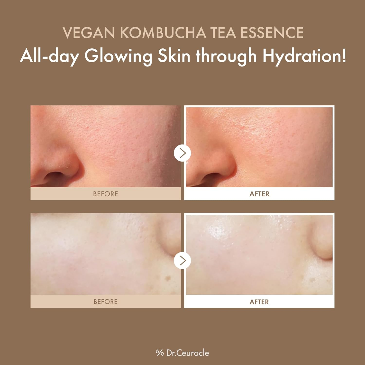 Dr.Ceuracle Vegan Kombucha Tea Essence 150 mL